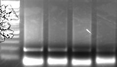 αντιδραστήριο DMSO, διότι η αλληλουχία που μας ενδιαφέρει είναι πλούσια σε βάσεις GC, με αποτέλεσμα το DMSO να βοηθάει στην αποδιάταξη του DNA.
