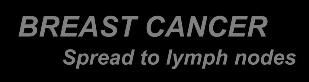 BREAST CANCER Spread to lymph nodes Supraclavicular Subclavicular Distal (upper) axillary