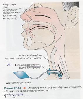 δνθηκαζία αζζελή κε