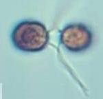 Ζυγώτης (2n) Ζωοσπόρια Ώριμο κύτταρο (n) + Γαμέτης (n)