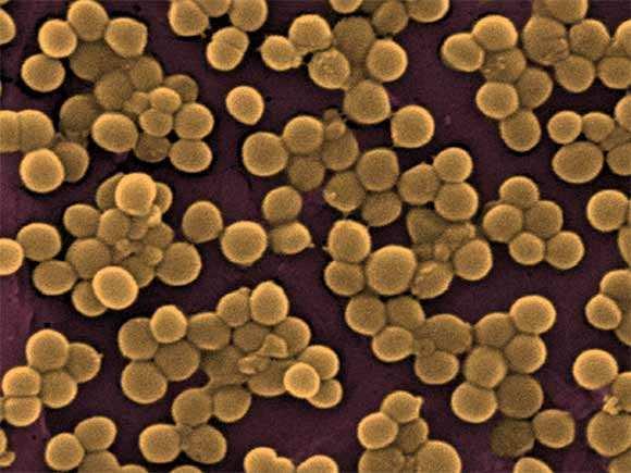 prevenirea toxiinfecțiilor alimentele nu se lasă la temperatura camerei păstrarea alimentelor la frigider alimentele se prepară termic rapid, pentru a nu permite multiplicarea bacteriilor igienă