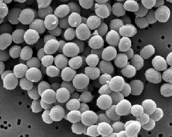Gram Produs patologic, Col.