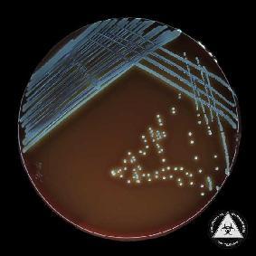 pe medii solide: Colonii: S în medii lichide tulburare uniformă cu depozit moderat la fundul tubului Pigment: galben-auriu (Staphylococcus aureus) alb (Staphylococcus