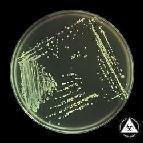 aureus pe G-sg coloniile sunt de 1-2 mm, netede și au un aspect tipic: paint drop Catalazo-pozitivi S.