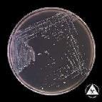 epidermidis Hidrolizează proteinele: hemoglobina, fibrina, cazeina, gelatina etc Colonii de stafilococ pe mediu Chapman Coloniile de S.