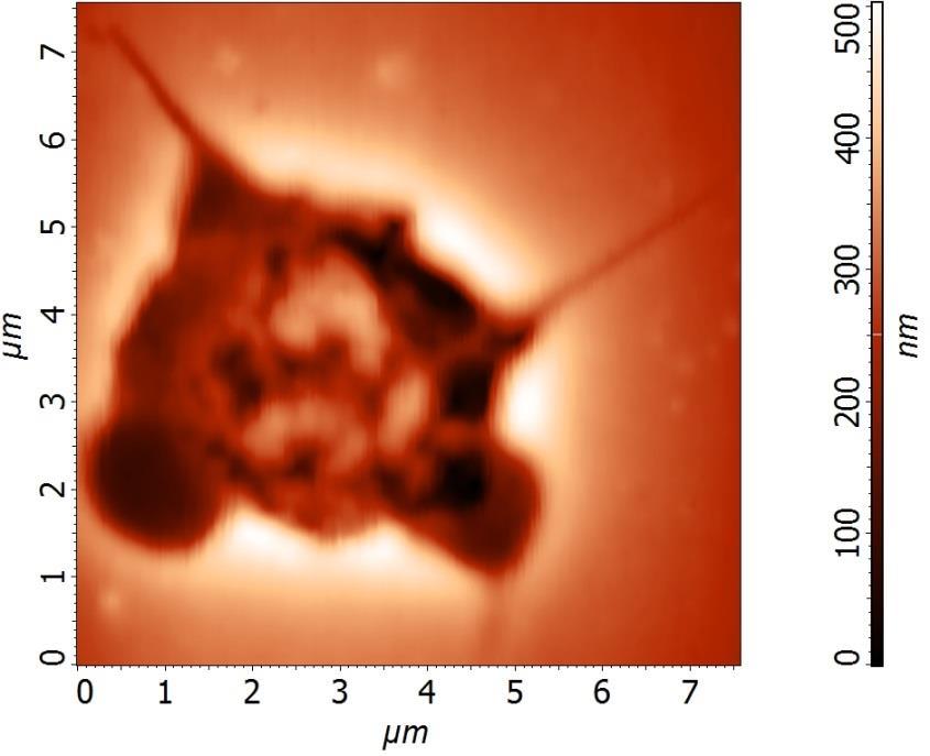 (1.5-3 μm) Ψευδοπόδια 