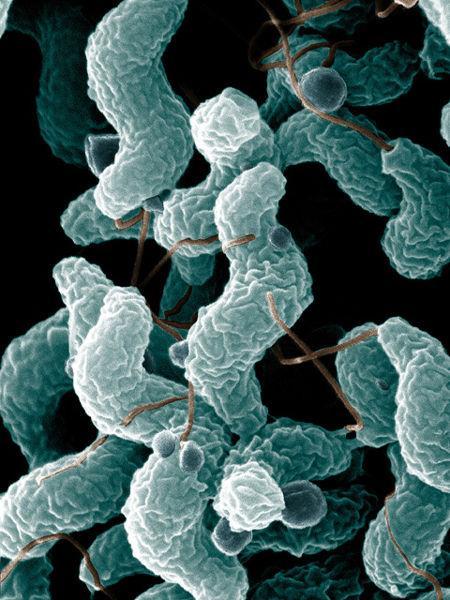 Παθογόνοι μικροοργανισμοί και Τροφικές ασθένειες Campylobacter jejuni, Campylobacter coli Καμπυλωτά ραβδιά της οικογένειας Campylobacteriacae Παράγουν εντεροτοξίνες παρόμοιες με αυτές τις χολέρας