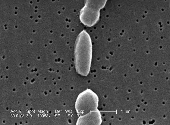 Παθογόνοι μικροοργανισμοί και Τροφικές ασθένειες Vibrio (V. parahaemolyticus, V.
