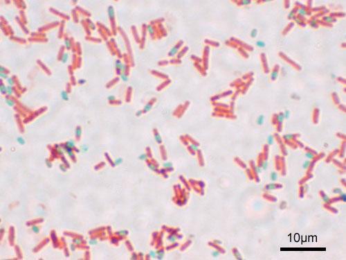 Παθογόνοι μικροοργανισμοί και Τροφικές ασθένειες Bacillus cereus Αερόβια σπορογόνα που παράγουν τοξίνες Παντού στη φύση (έδαφος, φυτά σκόνη) Δεν αναπτύσσεται κάτω από 4 C Συμπτώματα ανάλογα με είδος