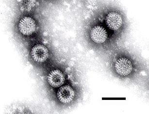 Παθογόνοι μικροοργανισμοί και Τροφικές ασθένειες Τροφογενείς Ιοί Λίγοι ιοί είναι τροφογενείς