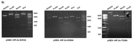 Β) Ηλεκτροφόρηση σε πηκτή αγαρόζης των τμημάτων DNA που προέκυψαν μετά από πέψη των πλασμιδίων pgex- HIF-2α-S383A pgex- HIF-2α-S386A και pgex- HIF-2α-T528A με τα ενδεικνυόμενα