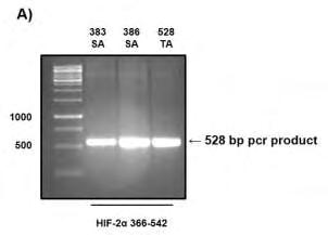 Επιπλέον, η αλληλουχία cdna που κωδικοποιεί το τμήμα 366-542 του HIF-2α που περιέχει τις μεταλλάξεις S383A, S386A και T528A, ενισχύθηκε με PCR και ακολούθησε κλωνοποίησή της στον πλασμιδιακό φορέα