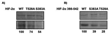 Εικόνα 51: Φωσφορυλίωση του HIF-2α πλήρους μεγέθους και του τμήματος 366-542 που περιέχουν τις μεταλλάξεις S383A και T528A in vitro χρησιμοποιώντας ως πηγή κινασών ολικά εκχυλίσματα κυττάρων Huh7.