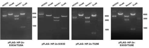 Β) Ηλεκτροφόρηση σε πηκτή αγαρόζης των τμημάτων DNA που προέκυψαν μετά από πέψη των πλασμιδίων pflag-hif-2α-wt, pflag-hif-2α-s383a, pflag-hif-2α-s386a και pflag-hif- 2α-T528A με τα ενδεικνυόμενα