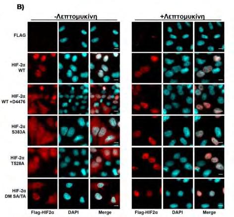 Εικόνα 63: Υποκυτταρικός εντοπισμός του HIF-2α WT και των μεταλλαγμάτων S383A, T528A και S383A/T528A υπό την επίδραση ή όχι των D4476 και LMB.