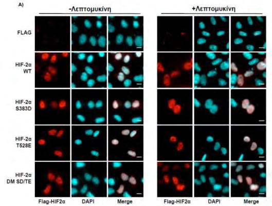 Εικόνα 64: Υποκυτταρικός εντοπισμός του HIF-2α WT και των φωσφομιμητικών μεταλλάξεων S383D, T528E και S383D/T528E υπό την επίδραση ή όχι LMB.