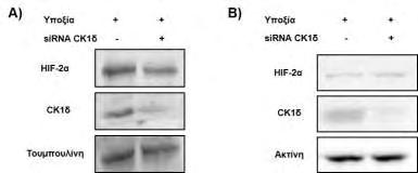 Εικόνα 36: Επίδραση της αποσιώπησης της έκφρασης της CK1δ µε sirna στην πρωτεϊνική έκφραση του HIF-2α.