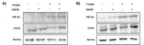 Β) Ανοσοαποτύπωση µε αντισώµατα έναντι στους HIF- 2α, CK1δ και ακτίνη ολικού εκχυλίσµατος κυττάρων HepG2 που διαμολύνθηκαν µε εναλλακτική αλληλουχία sirna-ck1δ (10 nm) και επωάστηκαν σε υποξία (1% Ο