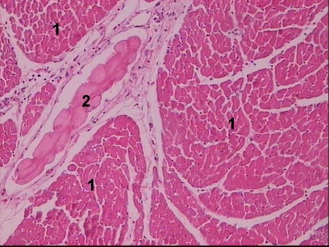 Δομή Ιστών Καρδιακός μυϊκός ιστός: Έλεγχος σύσπασης της καρδιάς (1) δεσμίδες καρδιακών μυϊκών ινών