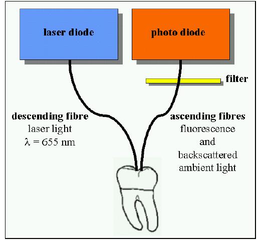 application of QLF and