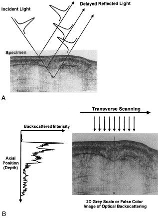 Οπτική Τομογραφία (Optical Coherence Tomography, OCT) Καταγράφοντας την καθυστέρηση του χρόνου "ηχούς" του