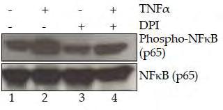 Στη συνέχεια προκειμένου να εξετάσουμε αν η αναστολή της αύξησης των επιπέδων του HIF-1α υπό την επίδραση του TNFα από το DPI οφείλεται σε αναστολή του μεταγραφικού μονοπατιού του NF-κB, μελετήσαμε