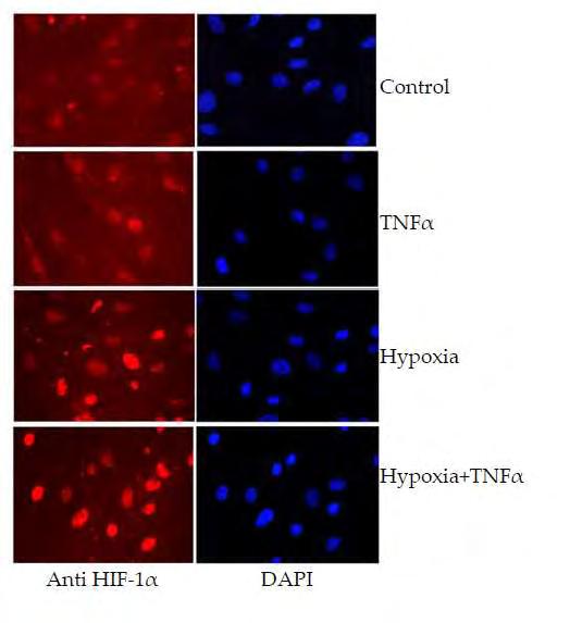 Εικόνα 26: Έλεγχος της ενδοκυτταρικής εντόπισης του HIF-1α σε ανθρώπινα ΛΜΚ κατόπιν επώασης για 4 ώρες με TNFα σε υποξία ή νορμοξία, με έμμεσο ανοσοφθορισμό με ειδικό αντίσωμα κατά του HIF-1α.