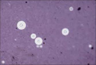 και Pneumocystis υπεύθυνα