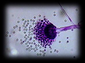 Pneumocystis Phylum: