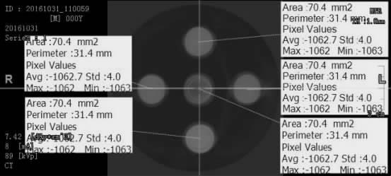 . CT A B 1 K HP CT Figure 1 The cone-beam CT values of the K HP body models CT 2 CT Figure 2 Cone-beam CT values of the proximal