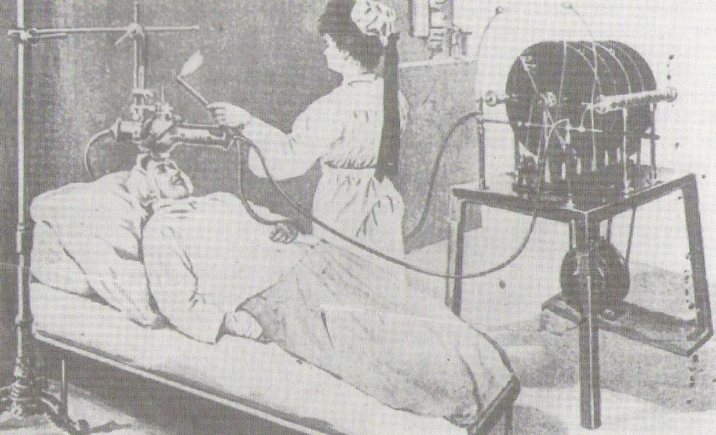 Ακτινοθεραπεία το 1896.