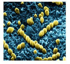 meningitidis