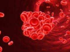 Obr: Zhluk zlepených červených krviniek