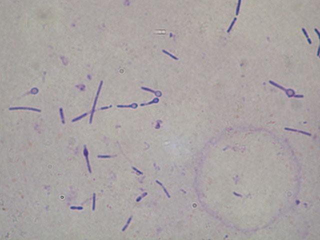 Clostridium tetani