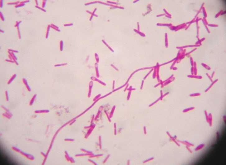 Clostridium