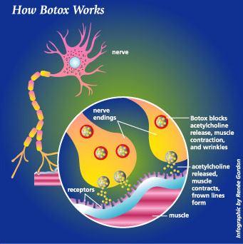 CLOSTRIDIUM BOTULINUM Toxina