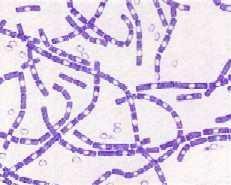 GENUL BACILLUS FROTIU