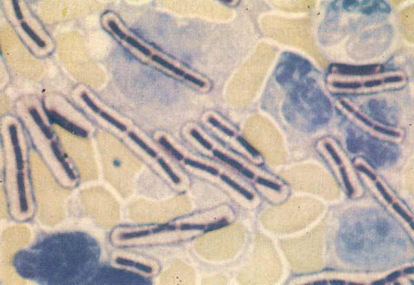 BACILLUS FROTIU COLORAT GRAM