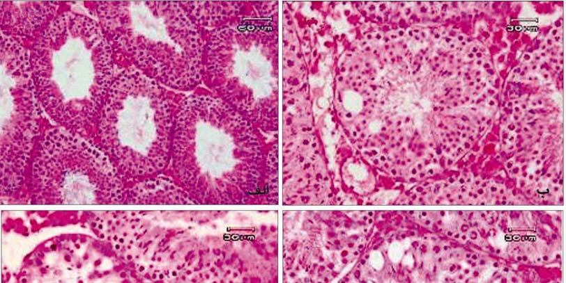 بافت بينابيني طبيعي بودند. لولههاي مني ساز محتوي اسپرم و اپيتليوم آن يكدست و فاقد شكاف بود (شكل 1). نتايج مشابهي براي مقاطع بافتي از بيضه در گروه آزمون جوان مشاهده گرديد (شكل 1).