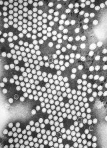 فلج اطفال polio or infantile paralysis, is an acute,