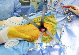 University. He completed his general surgical training at Georgetown University Medical Center and his orthopaedic surgical training at Brown University, Rhode Island Hospital. Dr.