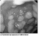 2011 Best practices for surveillance of Healthcare associated infections in patient and resident populations Λοιμώξεις από τη χρήση Συσκευών Ο παρανομαστής Device days προκύπτει από : το άθροισμα των