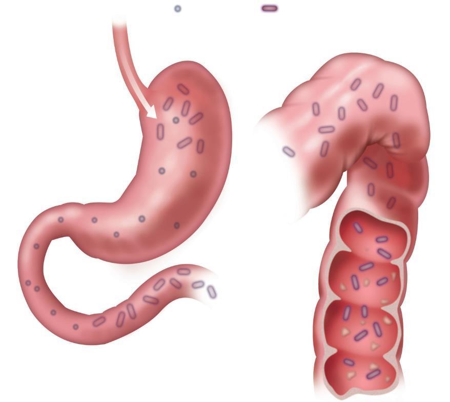 Κύκλος λοίμωξης με Clostridium difficile Καθοριστικής σημασίας οι σπόροι Κατάποση των σπόρων και των βλαστικών κυττάρων του C.