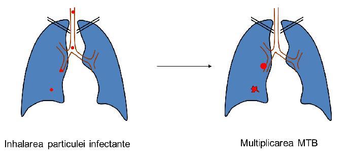 * factorii de risc colorati in rosu cresc riscul de dezvoltare a BOLII tuberculoase de peste 10 ori la cei INFECTATI alti factori de risc nefigurati sunt varstele extreme (< 5 ani) si tratamentele