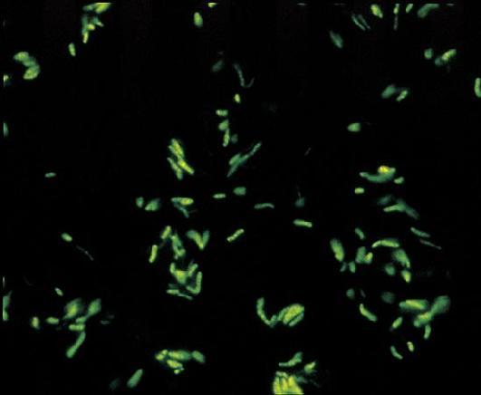 coloratie cu auramina O vizualizata in microscopul cu fluorescenta, 1000x Cultura micobacteriilor Metoda standard de diagnostic al TB Medii solide, de ex.