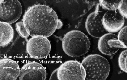 κάλυψη ατύπων Mediterranean area b-lactam + macrolide Υψηλή επίπτωση Legionella spp.