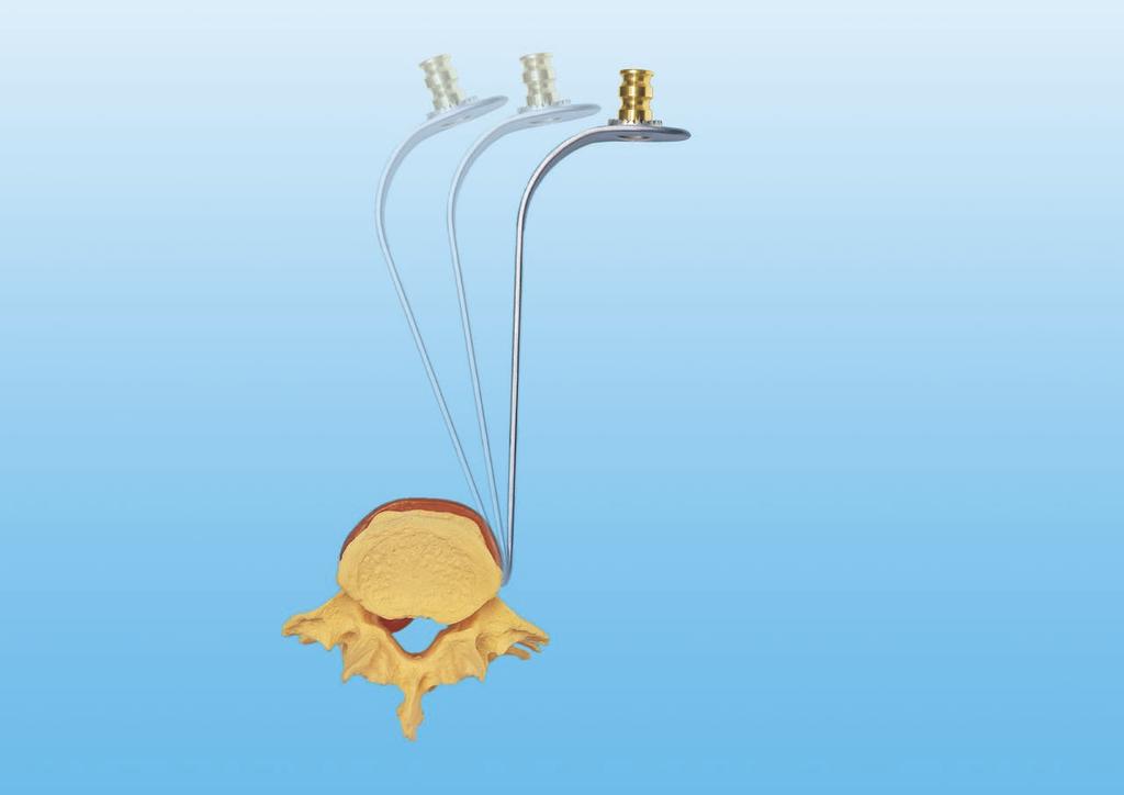 Uncompromised Exposure Lip stabilizes retraction by engaging the lateral aspect of the vertebral body.