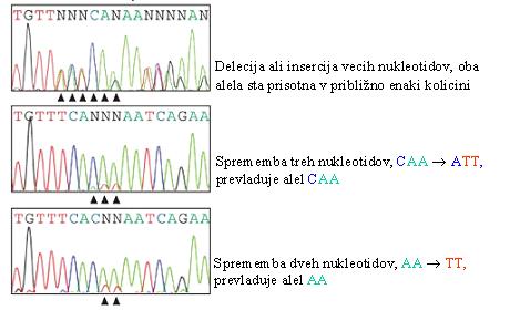 Slika 11: Shematičen prikaz elektroferogramov s spremenjenim nukleotidnim zaporedjem v heterozigotni obliki v različni koncentraciji alelov 1.