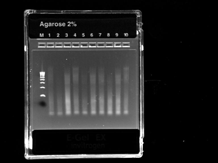 Slika 12: Elektroforeza neoptimiziranega PCR-ja za fragment A