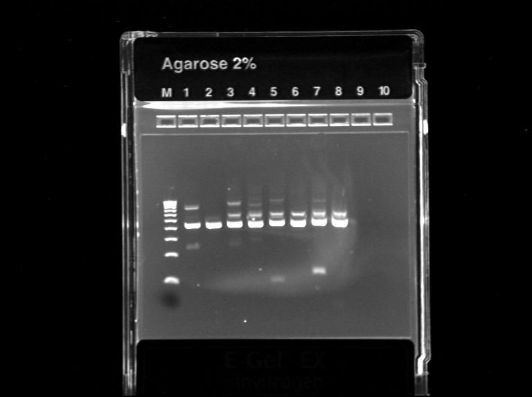 Slika 14: Optimizacija PCR-ja za fragment D pri različnih koncentracijah MgSO 4. 4.5.